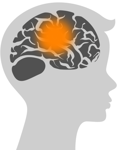 childhood-brain-cancer - The Swifty Foundation
